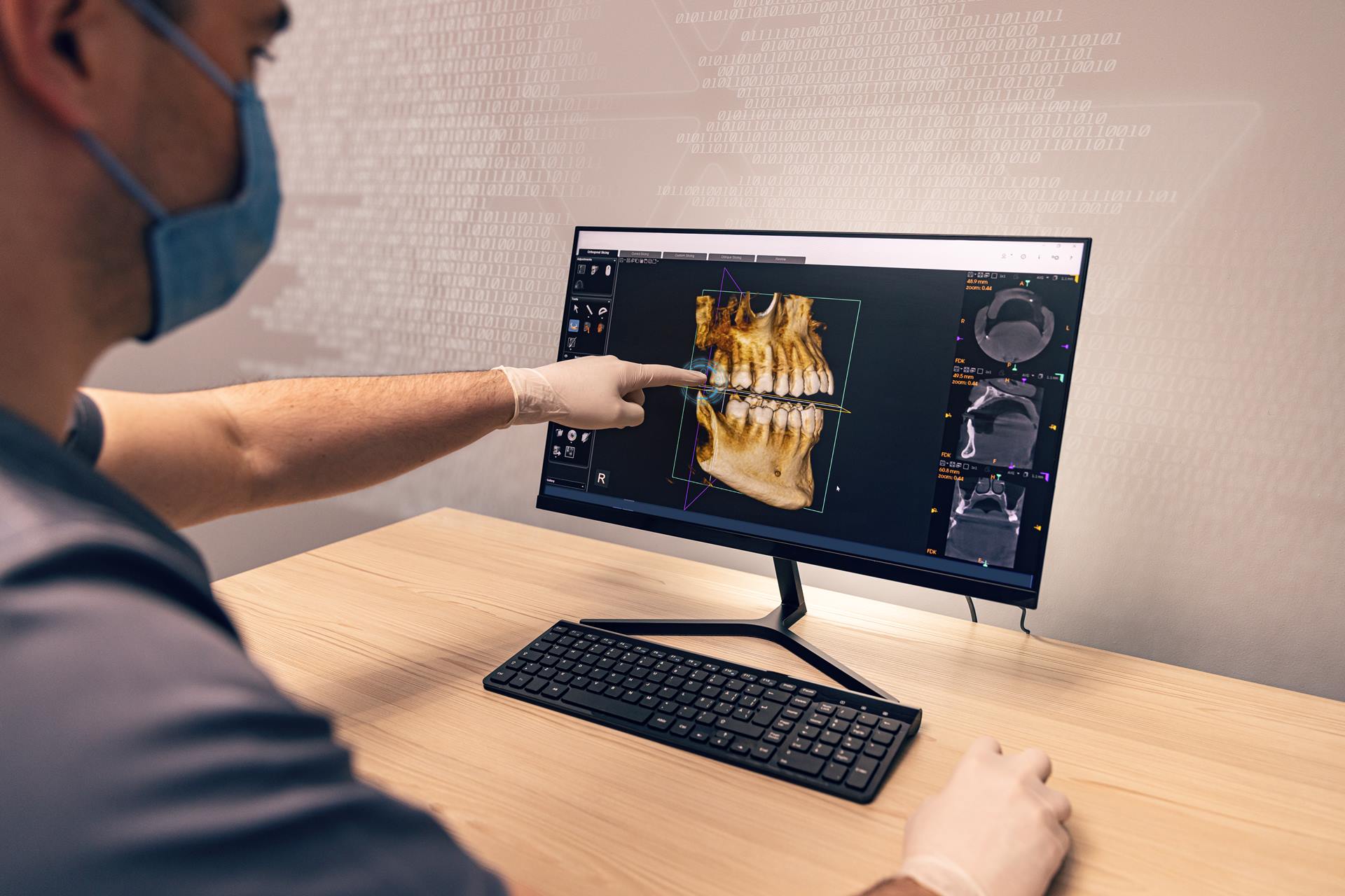 Autotrasplante Dental