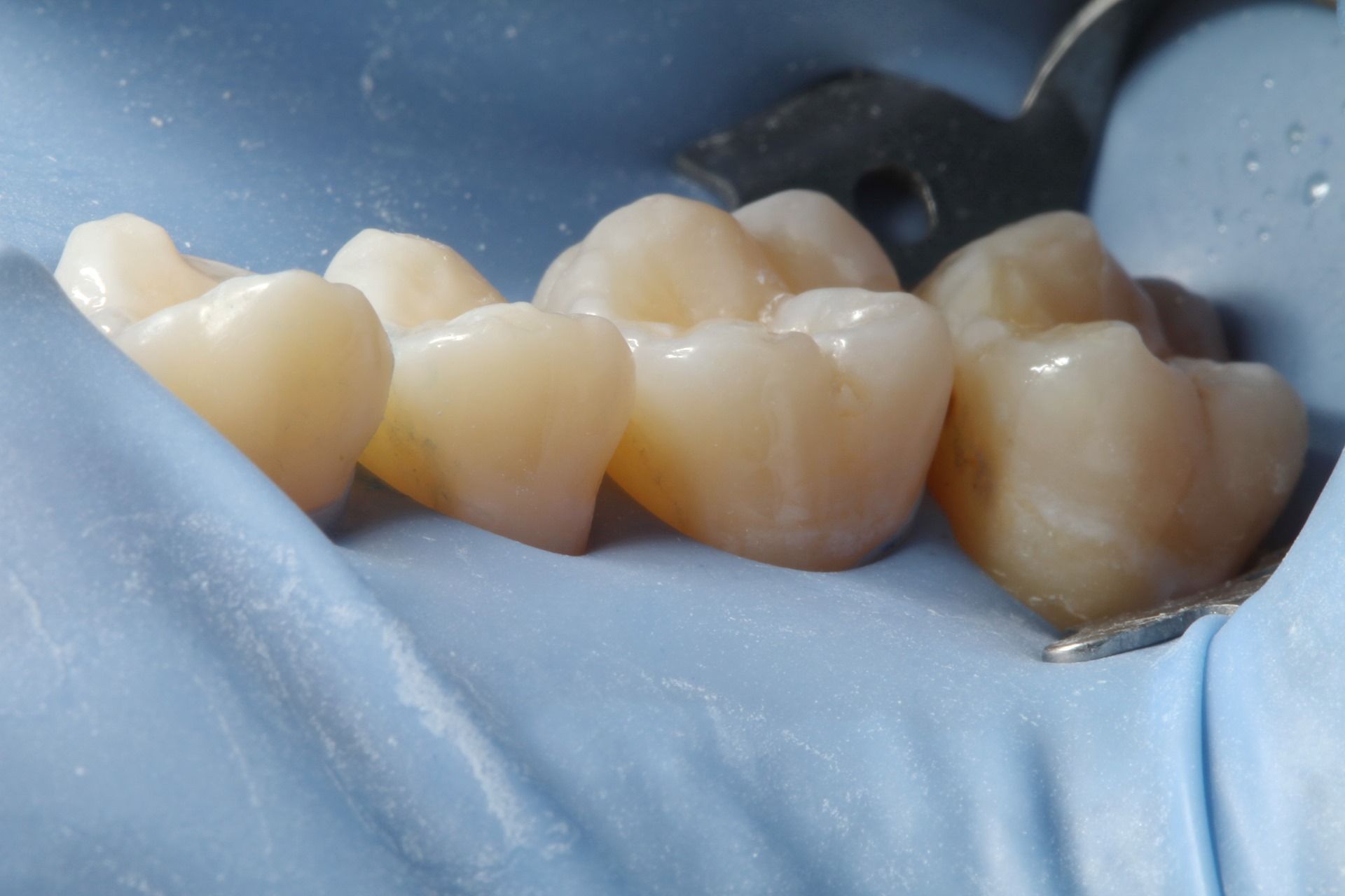 Odontología conservadora