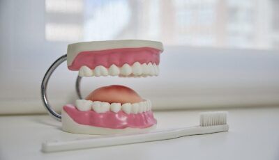 Caries Dental