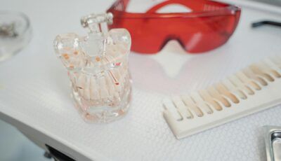 Blanqueamiento Dental: Guía Completa